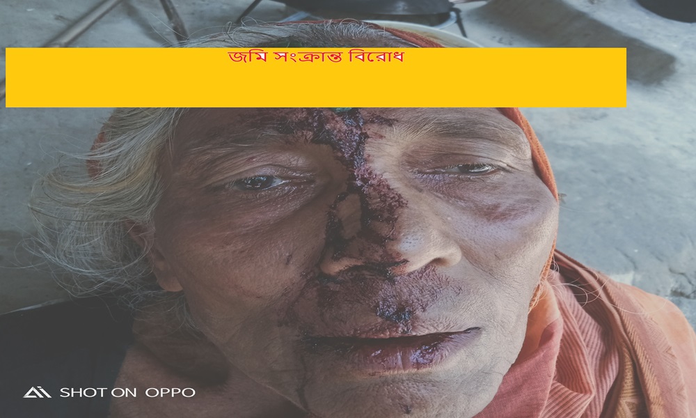 পাইকগাছার কপিলমুনির সলুয়ায় কুপিয়ে একই পরিবারের আহত ৬
